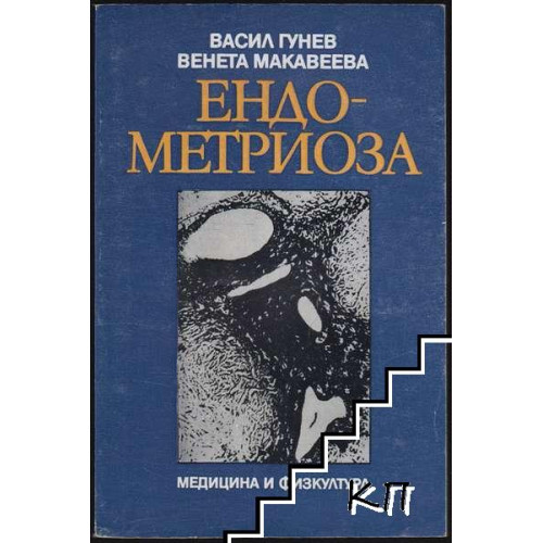 Ендометриоза, Гунев 1985г.
