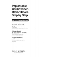 Implantable cardioverter defibrillators step by step