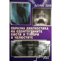 Образна диагностика на одонтогенните кисти и тумури в челюстите Образна диагностика на одонтогенните кисти и тумури в челюстите