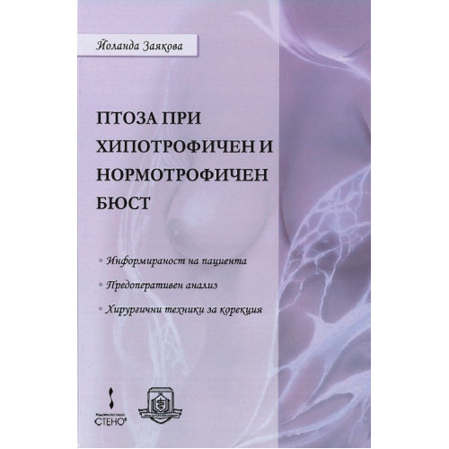 Птоза при хипотрофичен и нормотрофичен бюст Птоза при хипотрофичен и нормотрофичен бюст