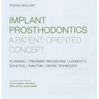 Implant prosthodontics a patent-orented concept Implant prosthodontics a patent-orented concept