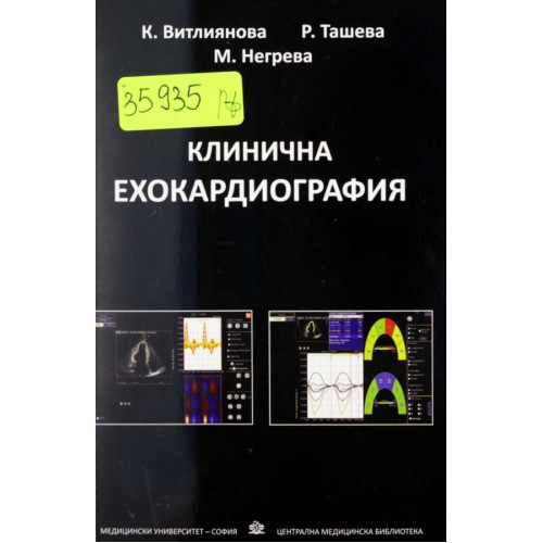 Клинична ехокардиография, Витлиянова, Ташева, Негрева 2018 Клинична ехокардиография, Витлиянова, Ташева, Негрева 2018