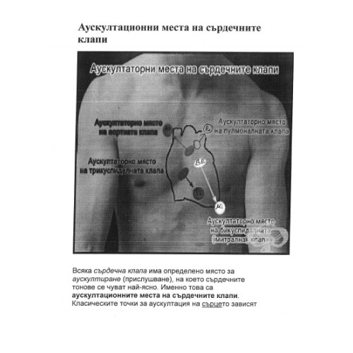 Аускултационни места на сърдечните клапи