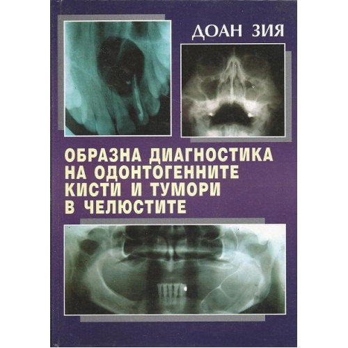 Образна диагностика на одонтогенните кисти и тумори в челюстите 