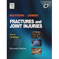 Fractures and Joint Injuries Jones Fractures and Joint Injuries Jones