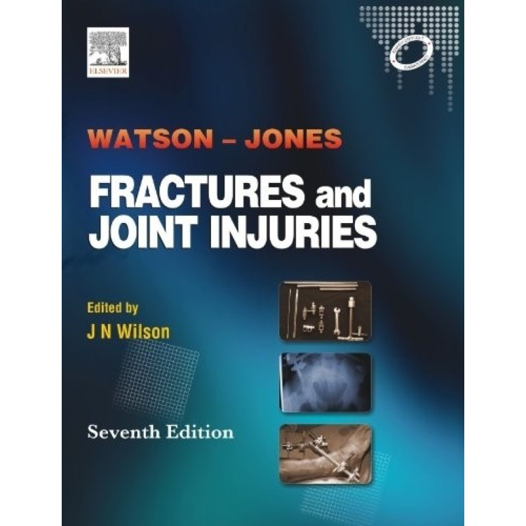 Fractures and Joint Injuries Jones