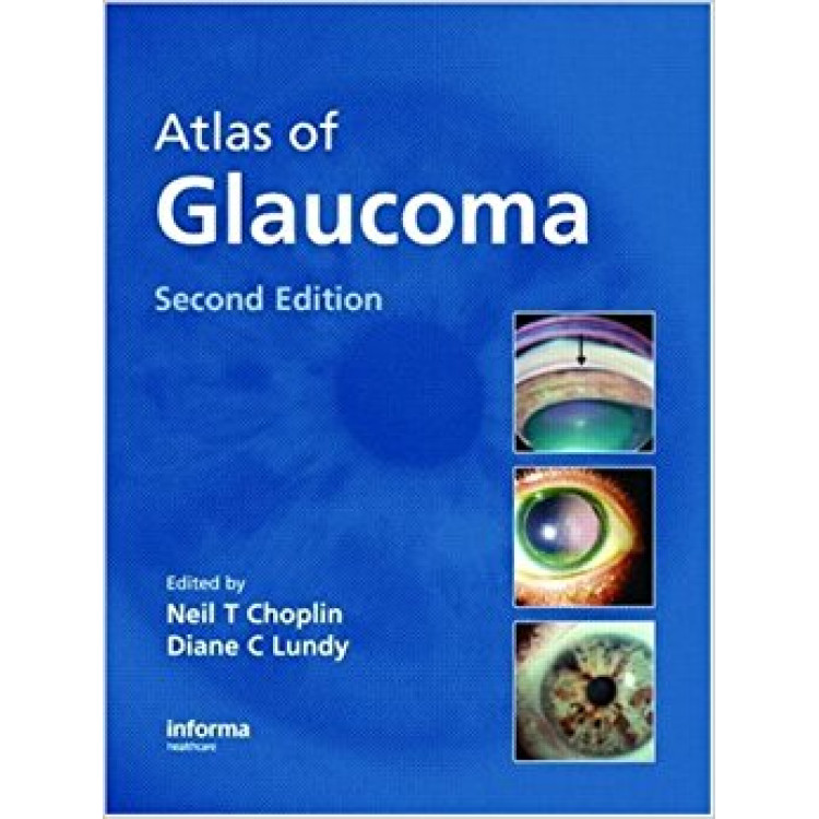 Atlas of Glaucoma Second Edition