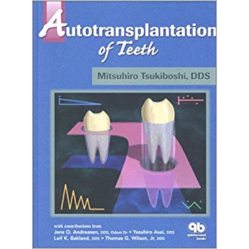 Autotransplantation of Teeth
