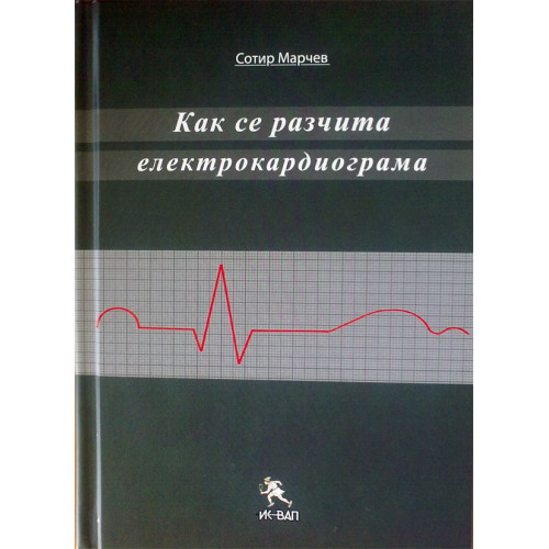 Как се разчита електрокардиограма, Марчев