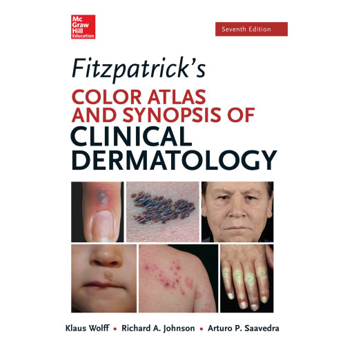 Fitzpatrick 39 s Color Atlas and Synopsis of Clinic Fitzpatrick 39 s Color Atlas and Synopsis of Clinic
