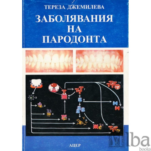 Заболяване на пародонта, Джемилева 1999г. Заболяване на пародонта, Джемилева 1999г.