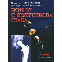 Живот с изкуствена става, Матцен, Танчев