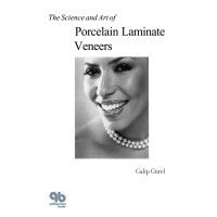 The Science and Art of Porcelain Laminate Veneers