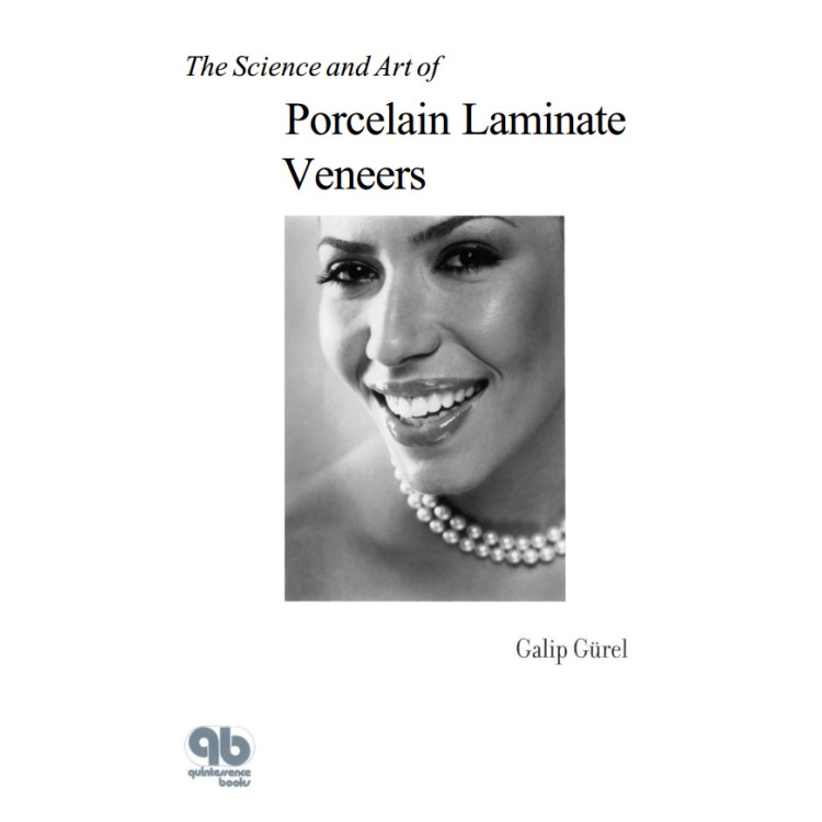 The Science and Art of Porcelain Laminate Veneers